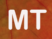 Moderna Teatern AB logotyp